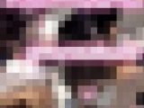 研修医の膣奥へカテーテル治療【女医の特別研修動画】